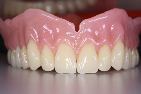 Braces With Partial Dentures Washington AR 71862